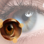 Grafika przedstawia miniaturkę zdjęcia oka na tle zbliżenia na oko.