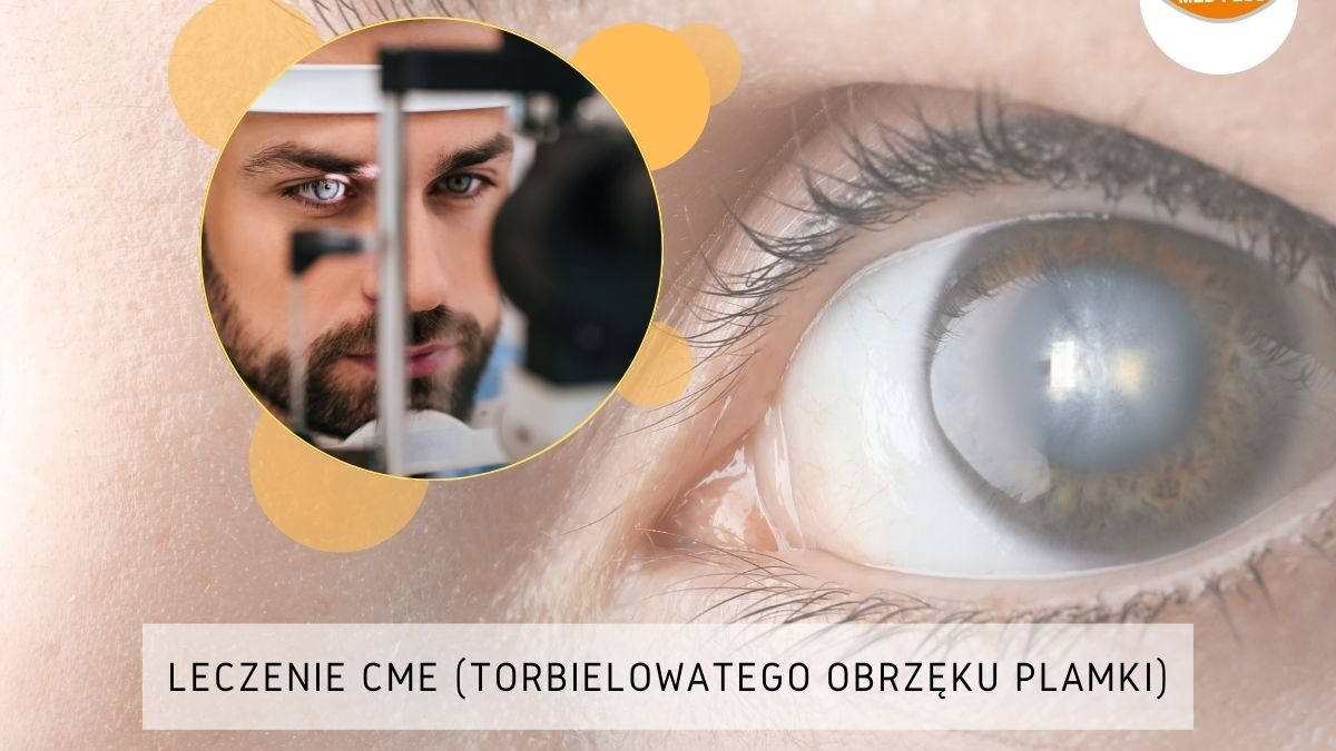 Grafika przedstawia miniaturkę zdjęcia mężczyzny podczas badania okulistycznego. W tle zdjęcie oka w zbliżeniu.