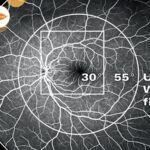 Grafika przedstawia wizualizację oka widocznego w urządzeniu okulistycznym.